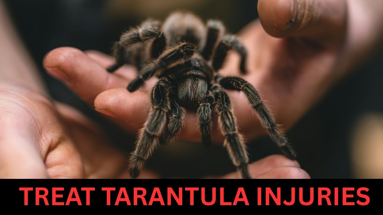 Tarantula Vet Advises Best Way To Treat Tarantula Injuries
