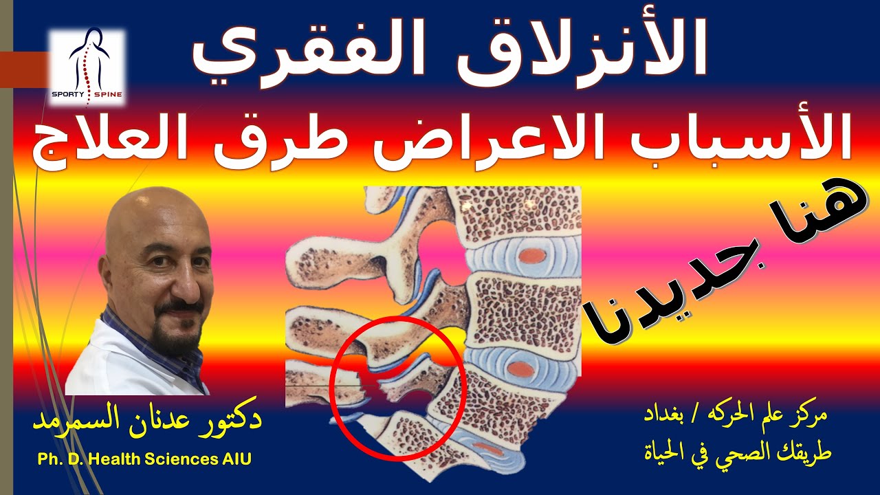 الأنزلاقات الفقرية بين الأعراض والتشخيص والعلاج يوضحها خبير علم الحركة الدولي دكتور عدنان السمرمد