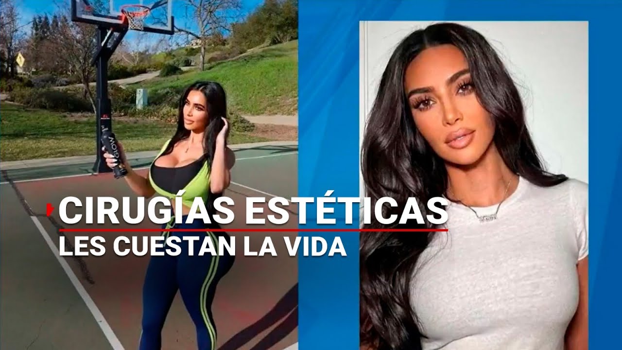 Las CIRUGÍAS de la muerte | Querer parecerse a una celebridad les costó la vida