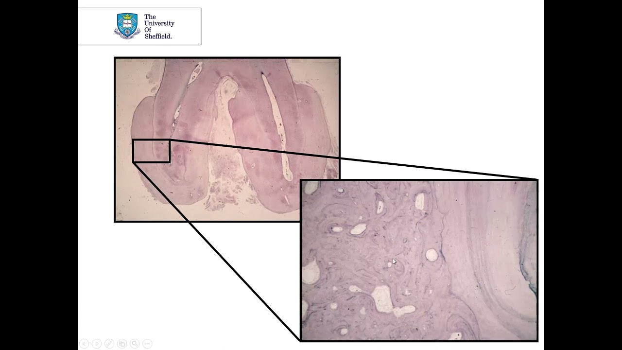 Periapical pathology Part 2