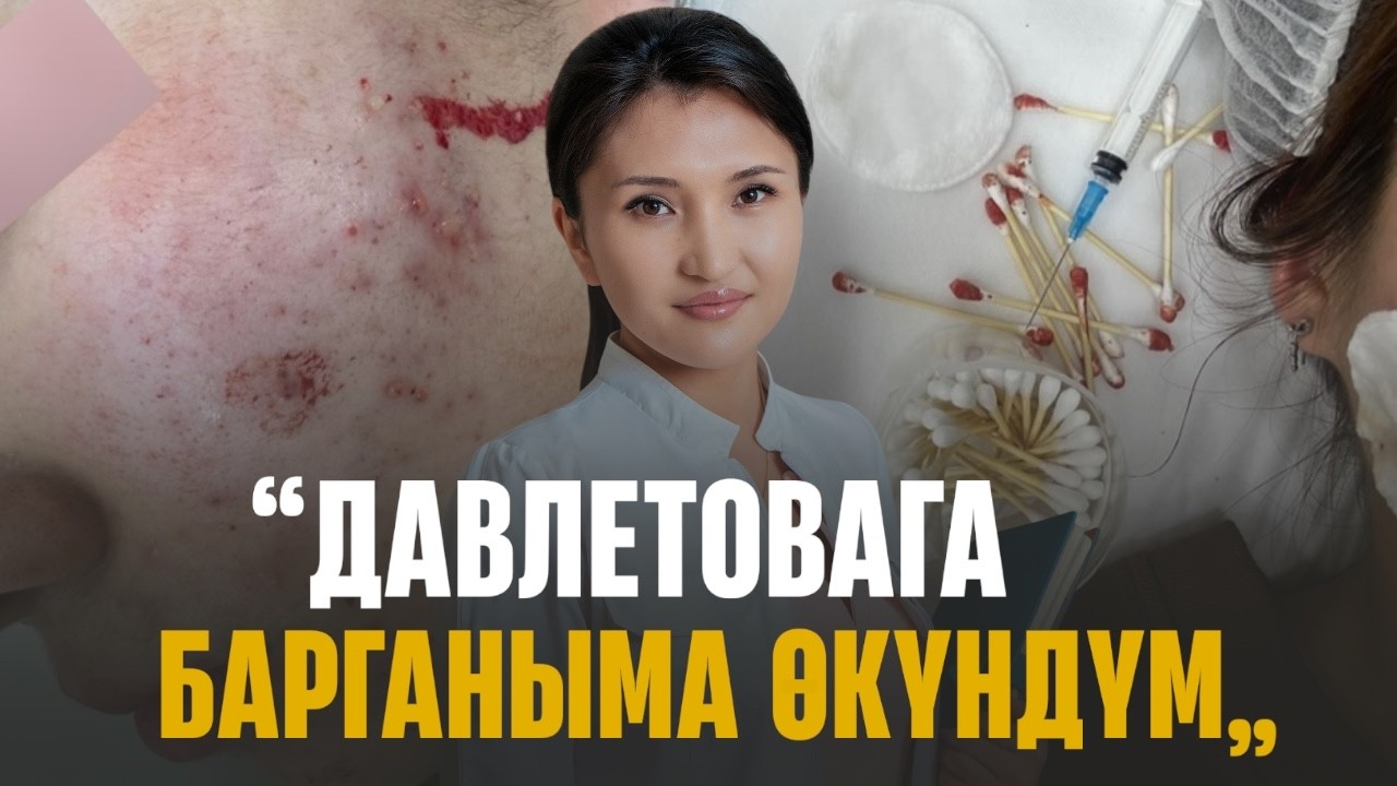 Косметолог негативге жооп берди || ЧЕКИТ МЕДИА