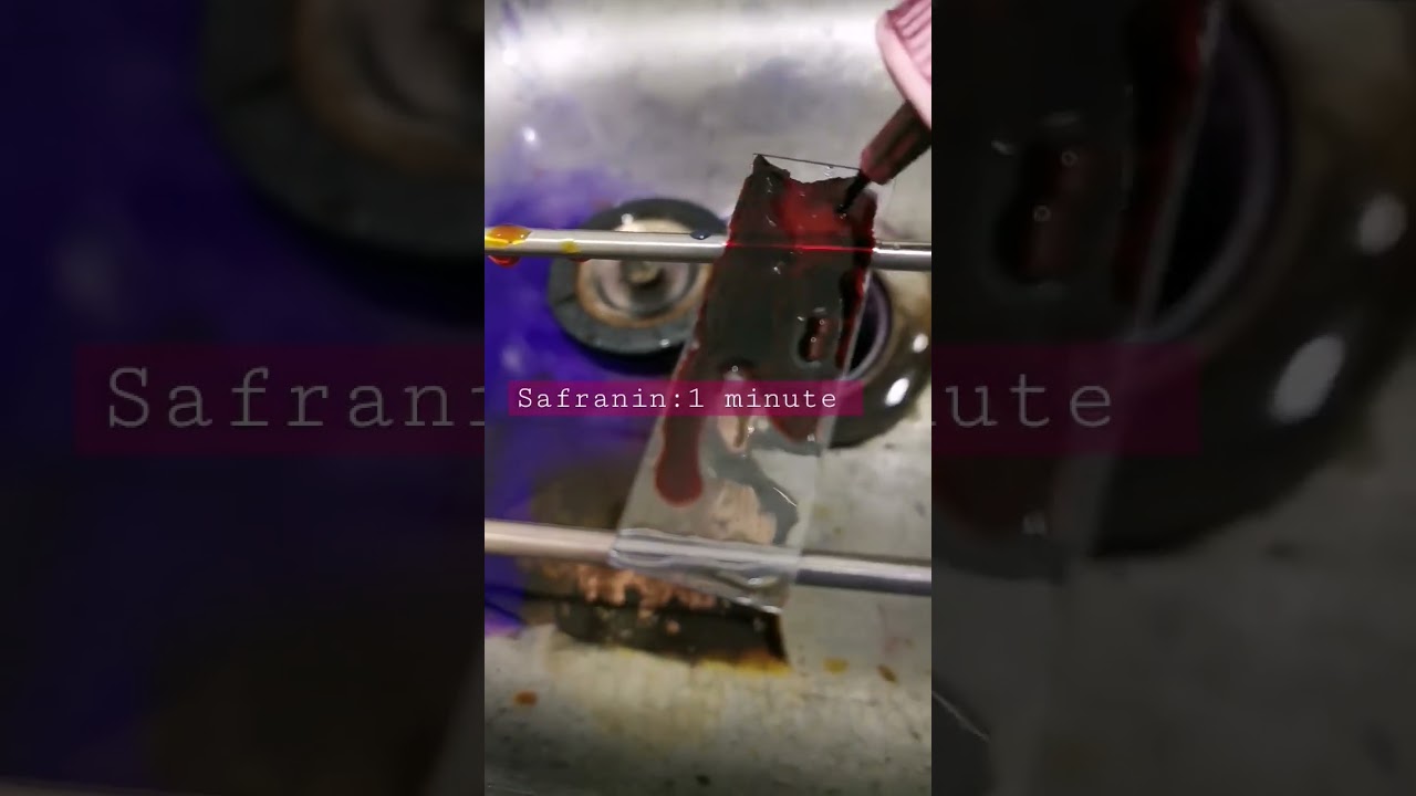Gram Staining procedure #microbiology #bacteria #medtechstudent #laboratory #mls #cls #microscope