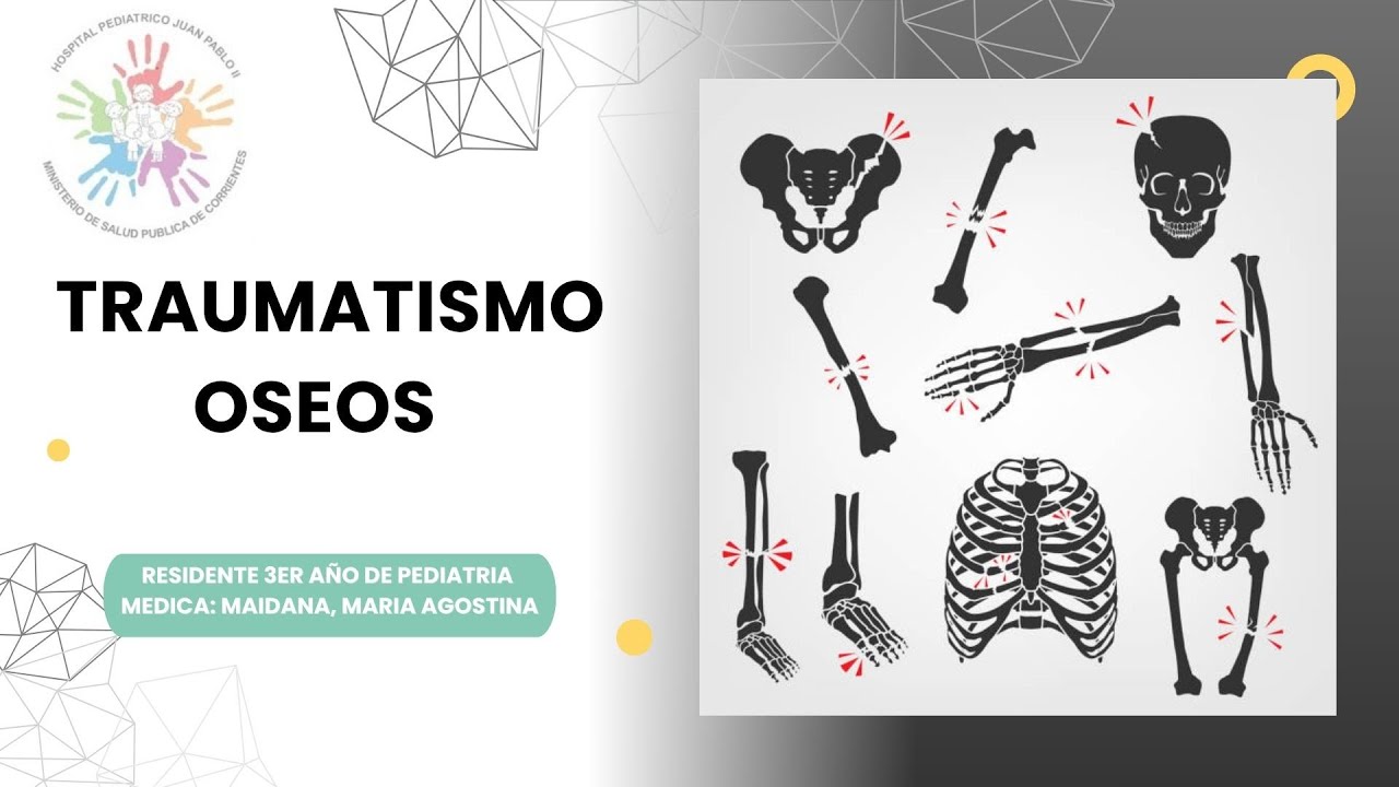 TRAUMATISMO OSEO