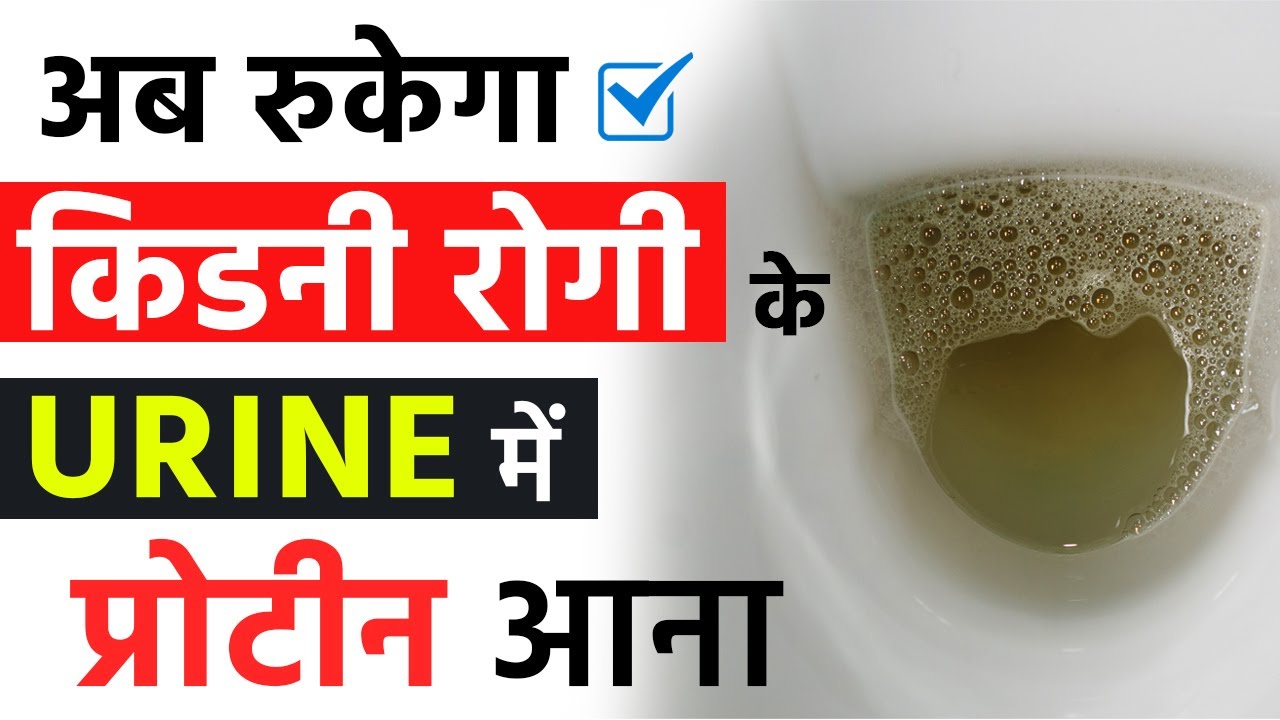 अब रुकेगा किडनी रोगी के URINE में प्रोटीन आना | Tips to Control Protein in Urine