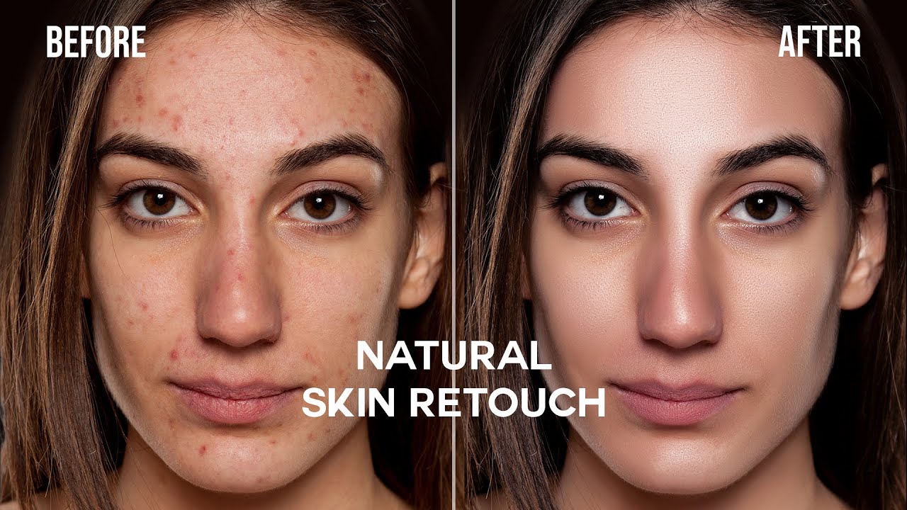 High-End Skin Retouching in Photoshop Tutorial 20 minutes | Frequency Separation