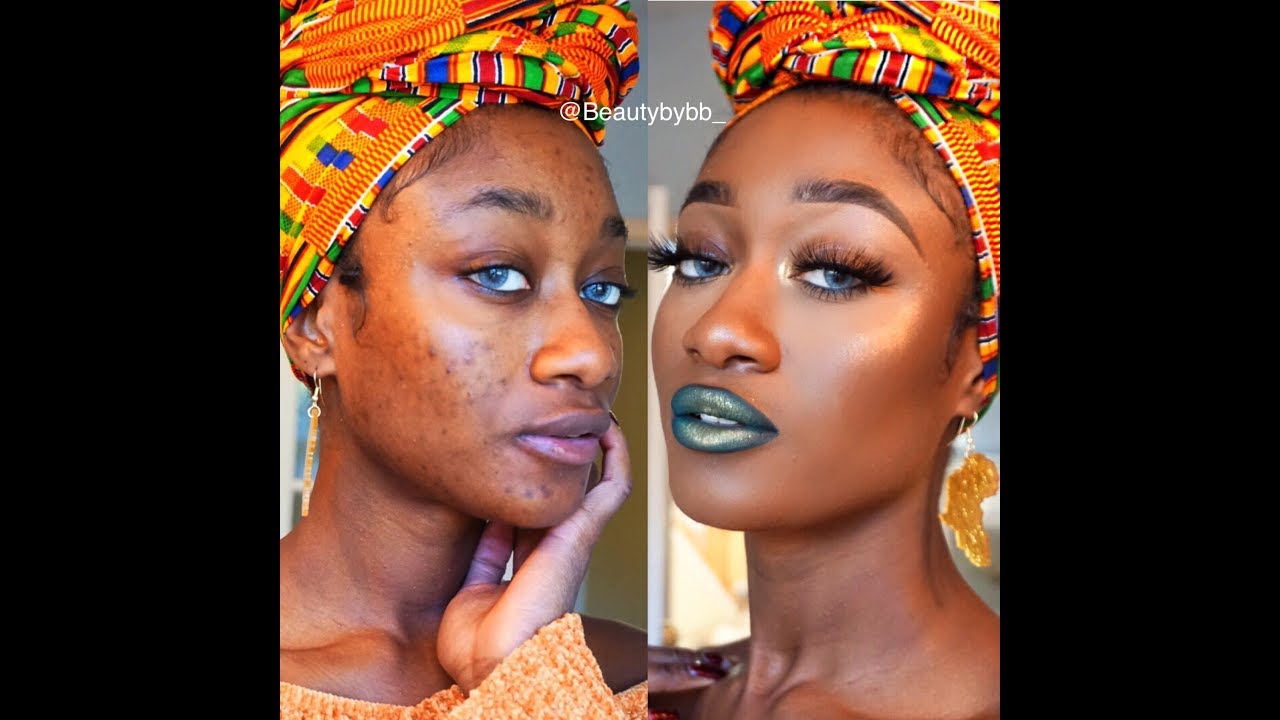 Full Acne Scar Coverage NO FOUNDATION NEEDED !! | Beautybybb_