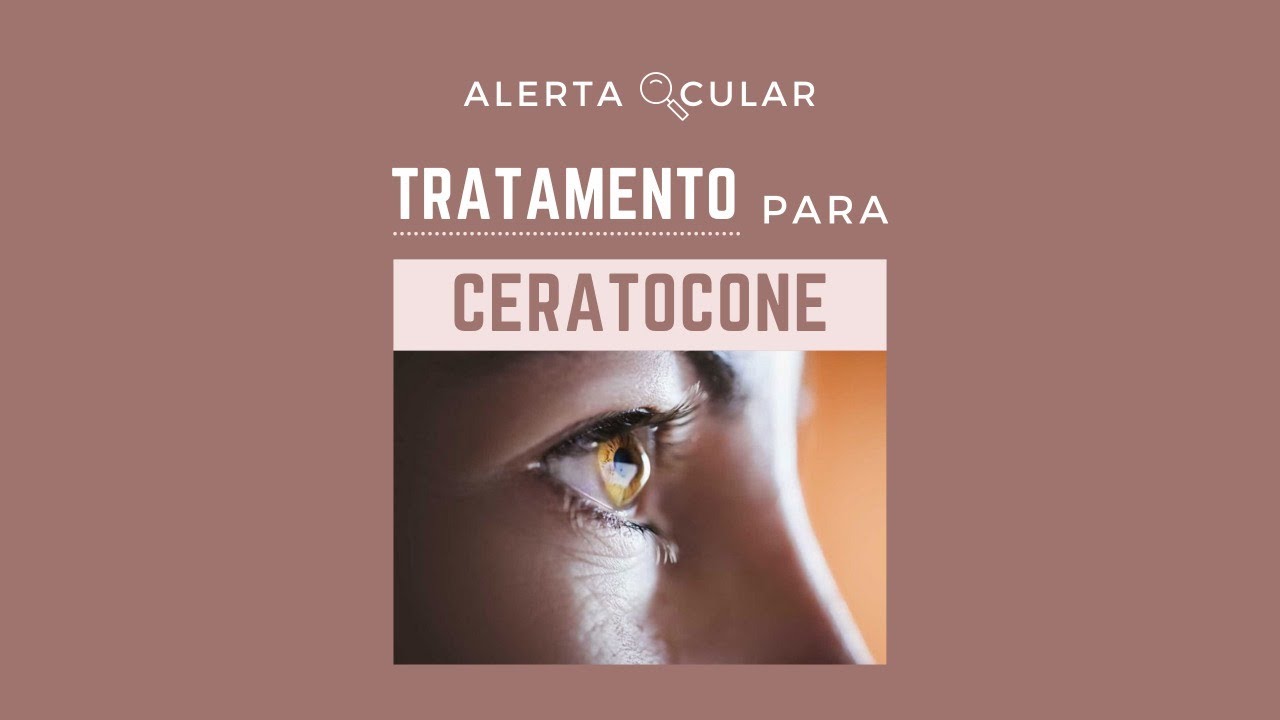 Tratamento para Ceratocone