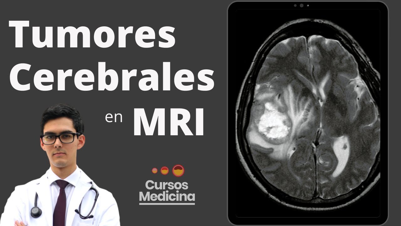 Reconocer Tumores Cerebrales en Resonancia Magnética (para Estudiantes de Medicina)