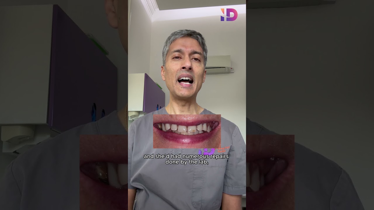 Dental Implant Case Explanation by Dr Neeraj Puri 🦷👏 #edinburgh #dentistry #dentalimplants #shorts