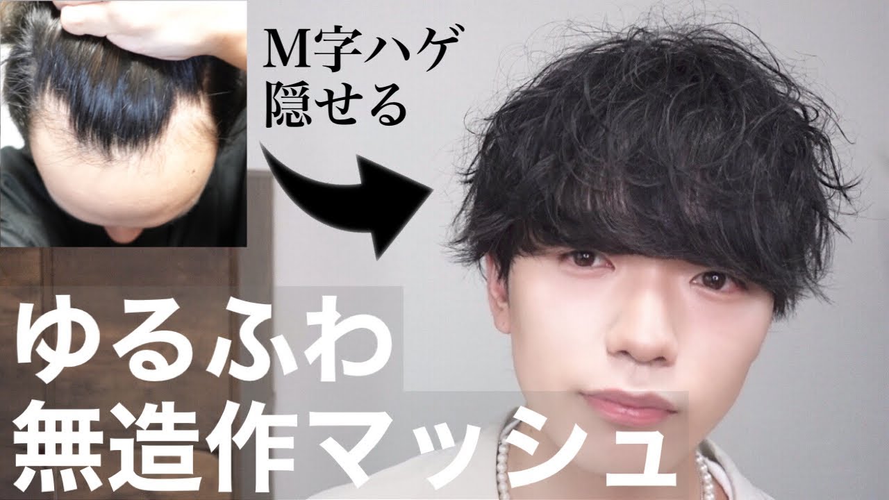【徹底解説】M字ハゲを隠せるゆるふわ無造作マッシュのセット方法！