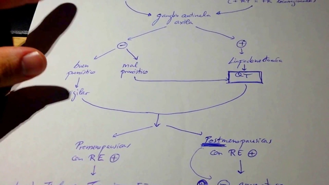 Cáncer de mama ESQUEMA FACILÍSIMO