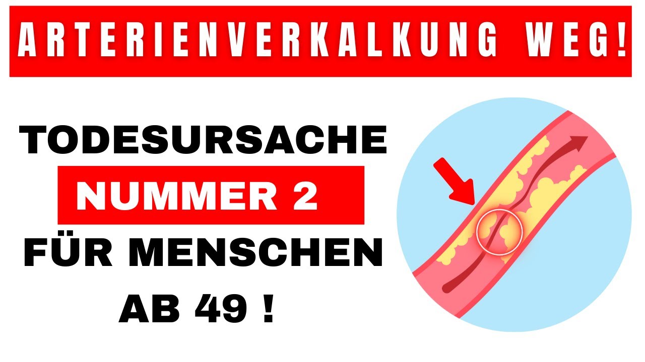 Die BESTEN &Ouml;le Zum Reinigen Ihrer Arterien (NAT&Uuml;RLICH)