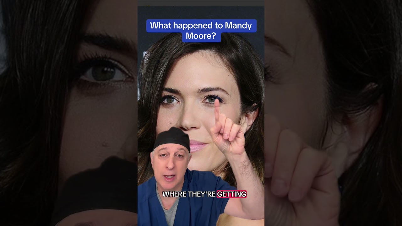What&rsquo;s up with Mandy Moore?  Looks like she may have undergone an upper lid blepharoplasty.