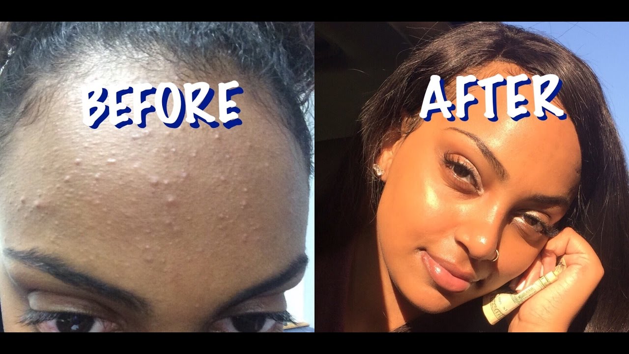 ✨MY SKIN CARE ROUTINE ✨