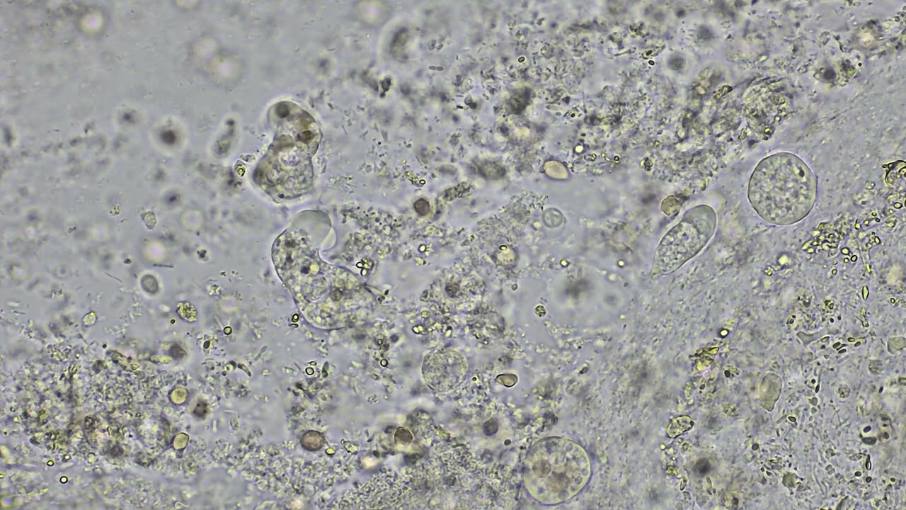 Entamoeba (Motile trophozoite)