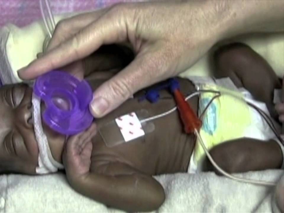 Supine Position / Positioning NICU patients with The Zaky / Instructional Video