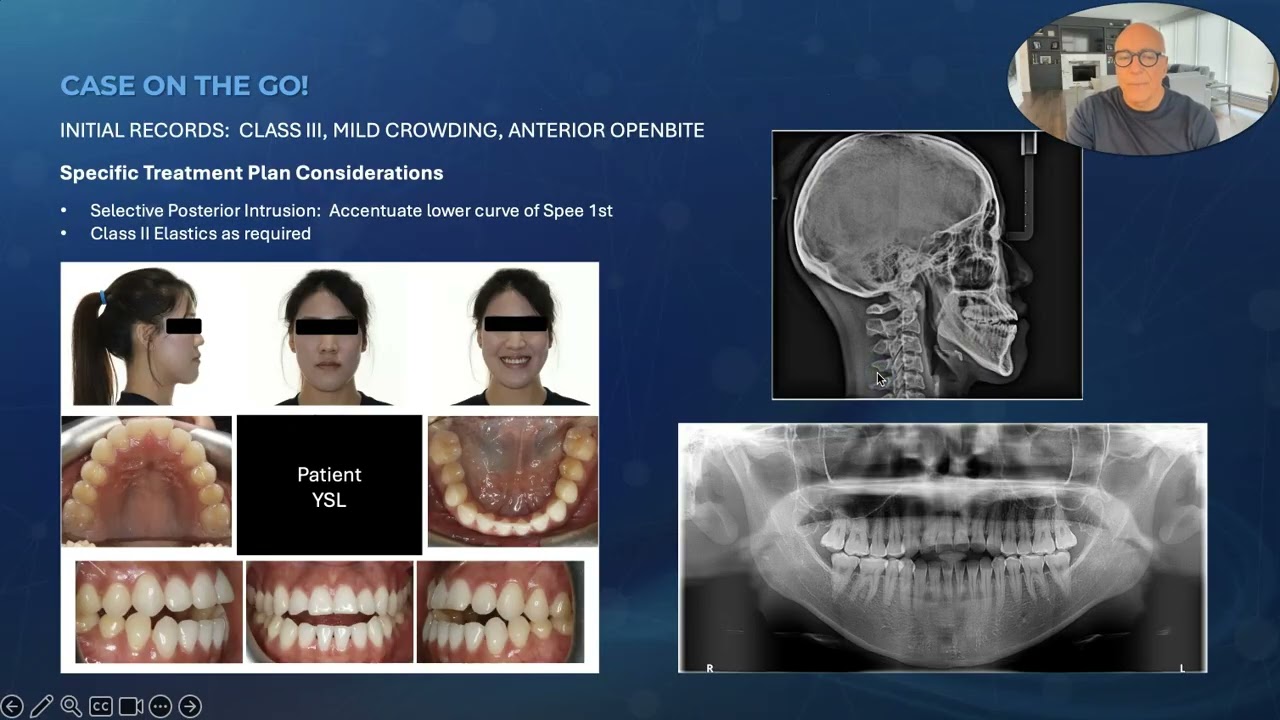 Complex Orthodontic Cases: Webinar July 31st, 2025