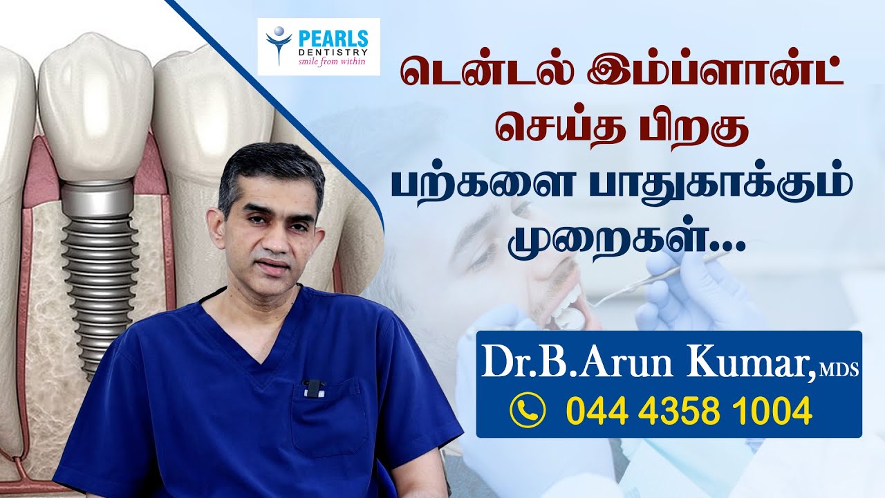 Post implant dental care..!- Pearls Dentistry - Dr.Arun Kumar