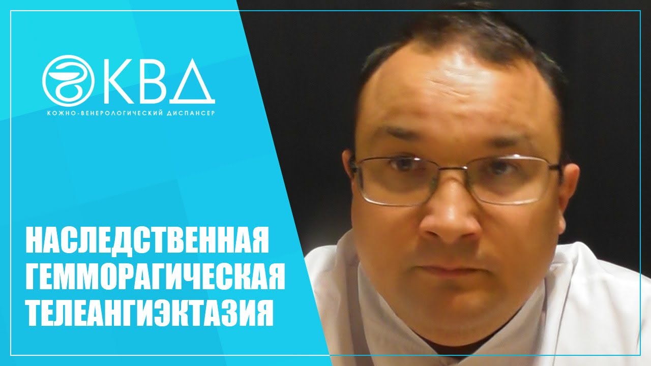 1419  Наследственная геморрагическая телеангиэктазия