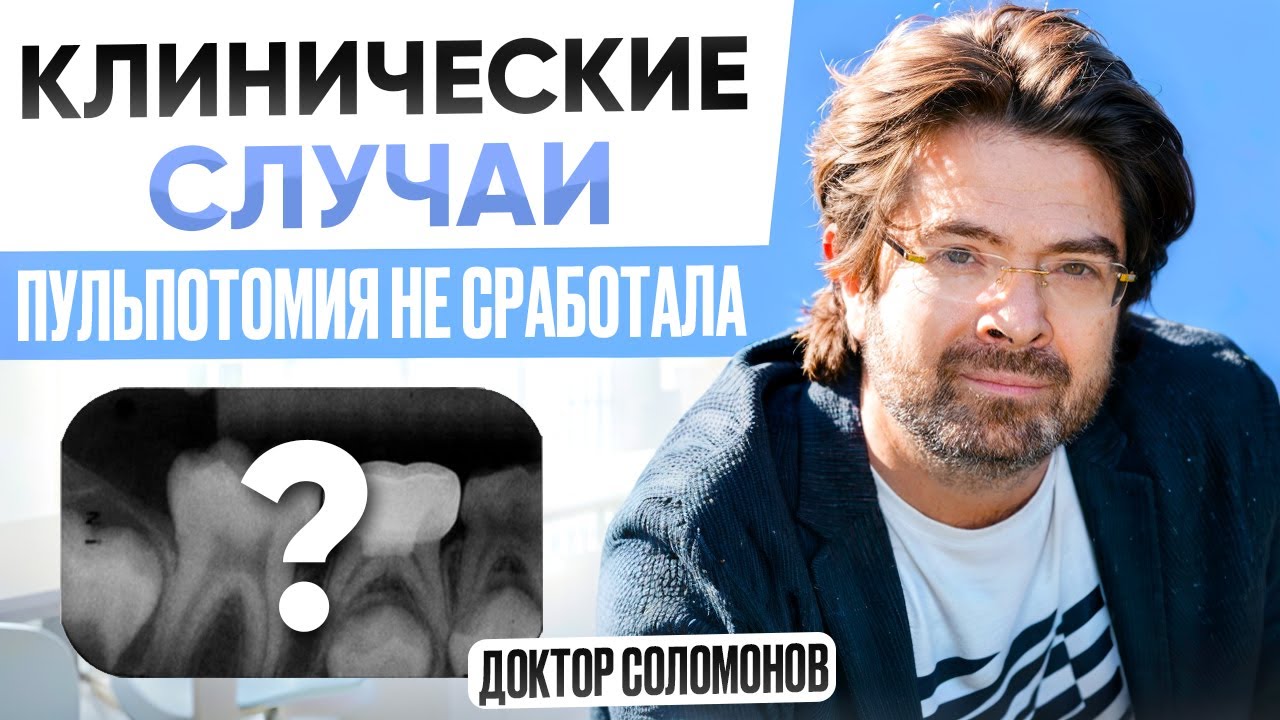 Пульпотомия не сработала: разбор клинического случая с ошибками и выводами