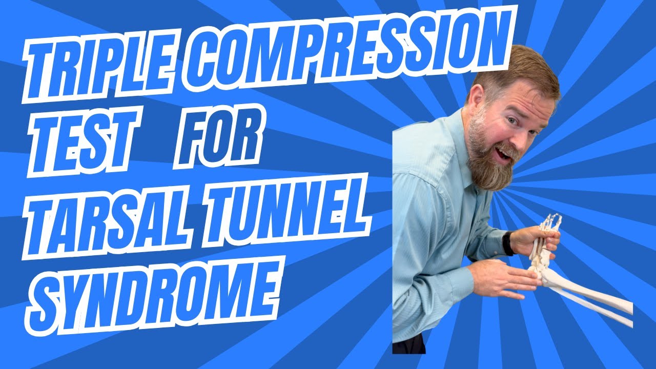 The Triple Compression Test for Tarsal Tunnel