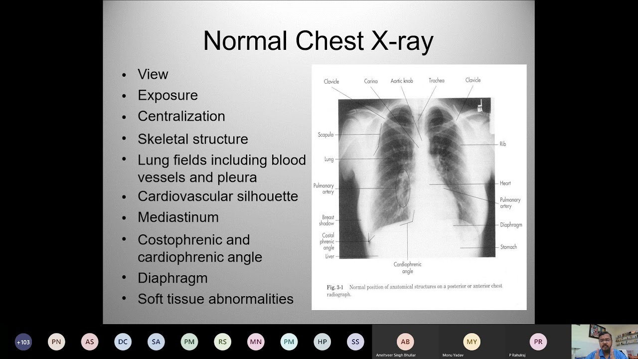 Surgery X Ray's in Surgery 16 June 2020