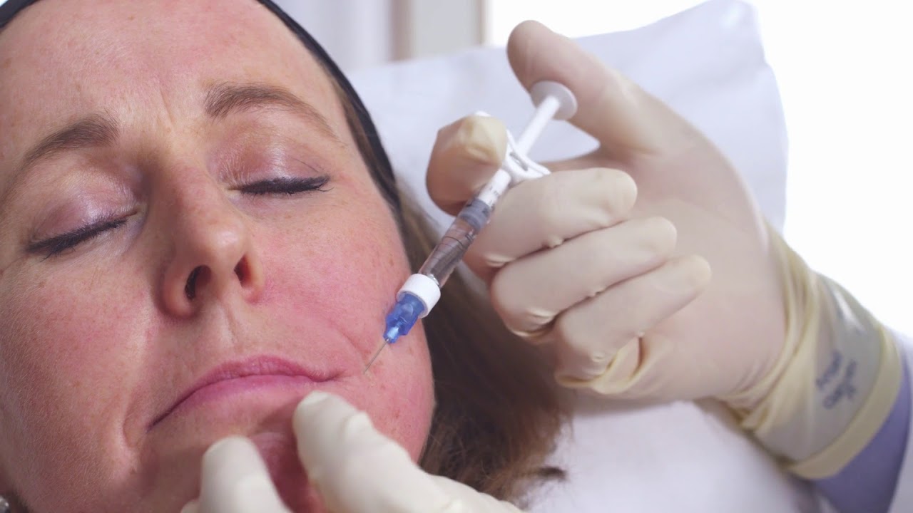 Restylane New Syringe Tech Inj Film final HD