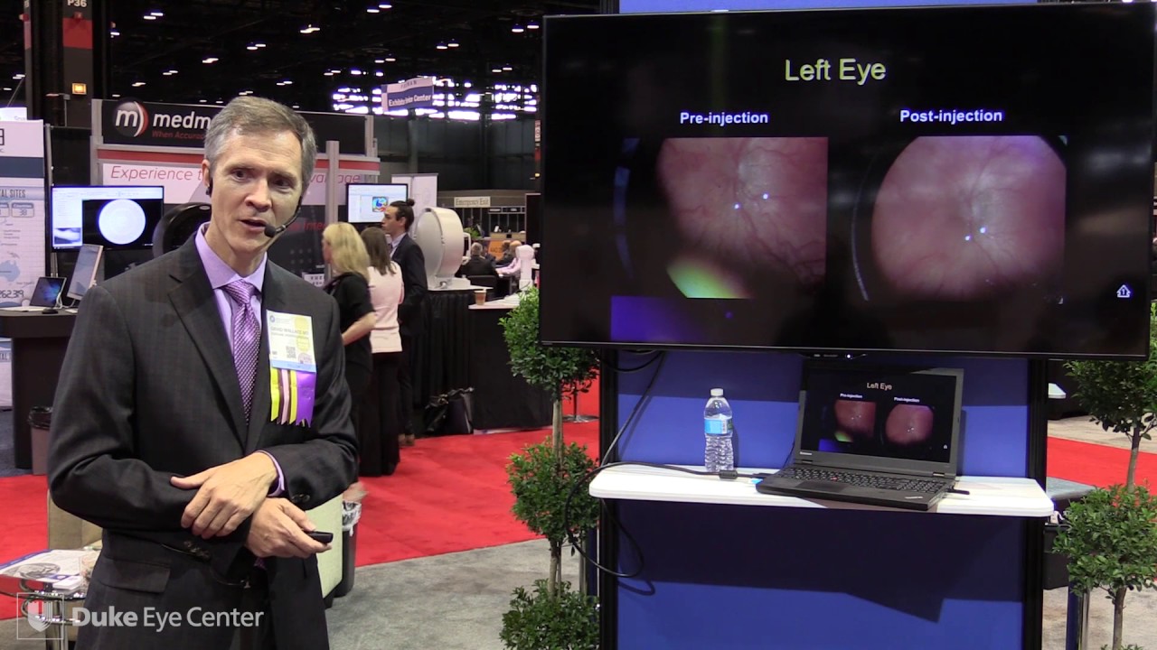 Lasers vs Anti-VEGF for ROP - David Wallace, MD - AAO 2016