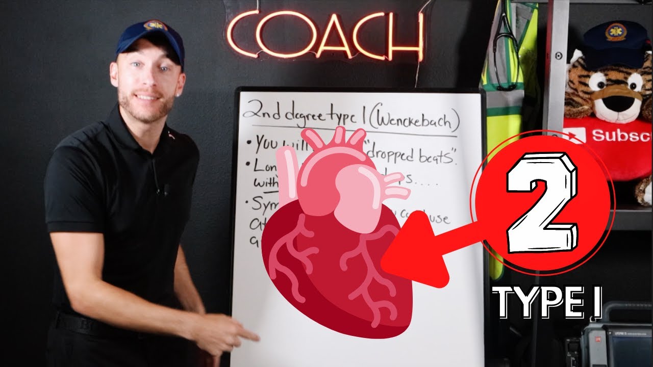 UNDERSTAND 2nd Degree Heart Block Type I