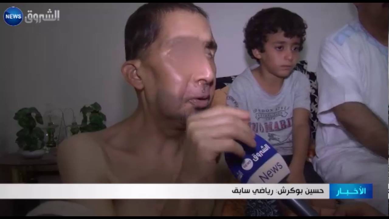 الجلفة: حسين بوكرش رياضي انقلبت حياته لمأساة بسبب السرطان