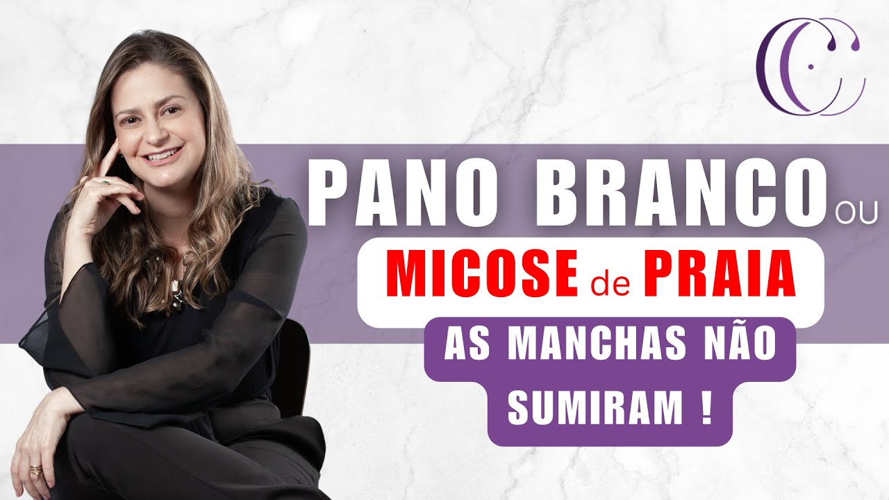PANO BRANCO ou "MICOSE de PRAIA":  tratei e as manchas não sumiram?