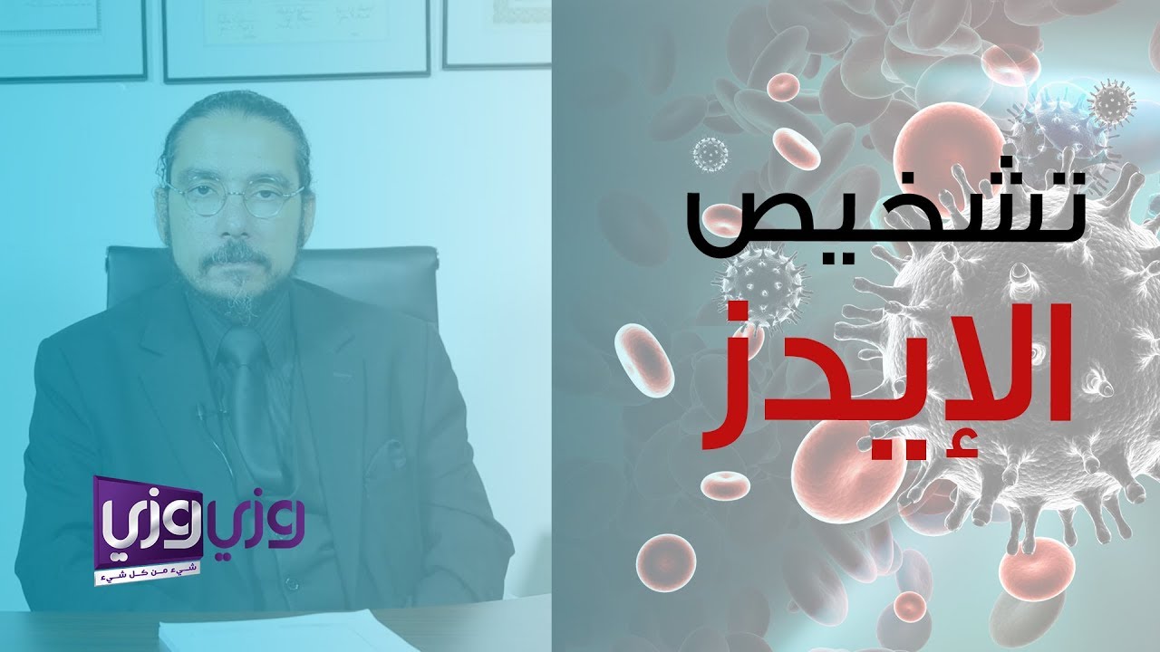 هل تحليل الدم الشامل يكشف الإيدز