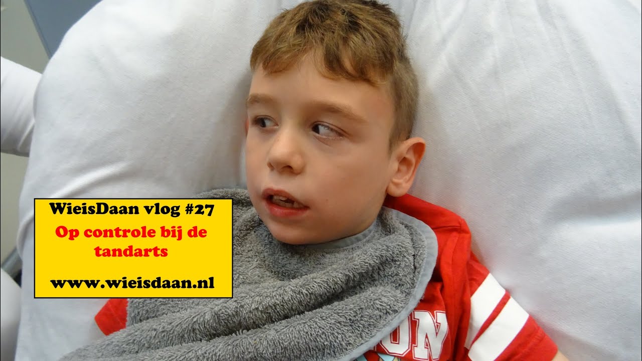 Daan gaat naar de tandarts - WieisDaan vlog #27