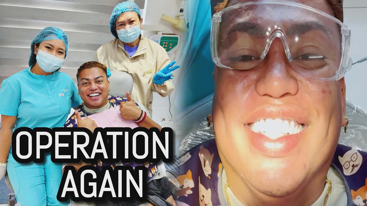 OPERATION AGAIN.