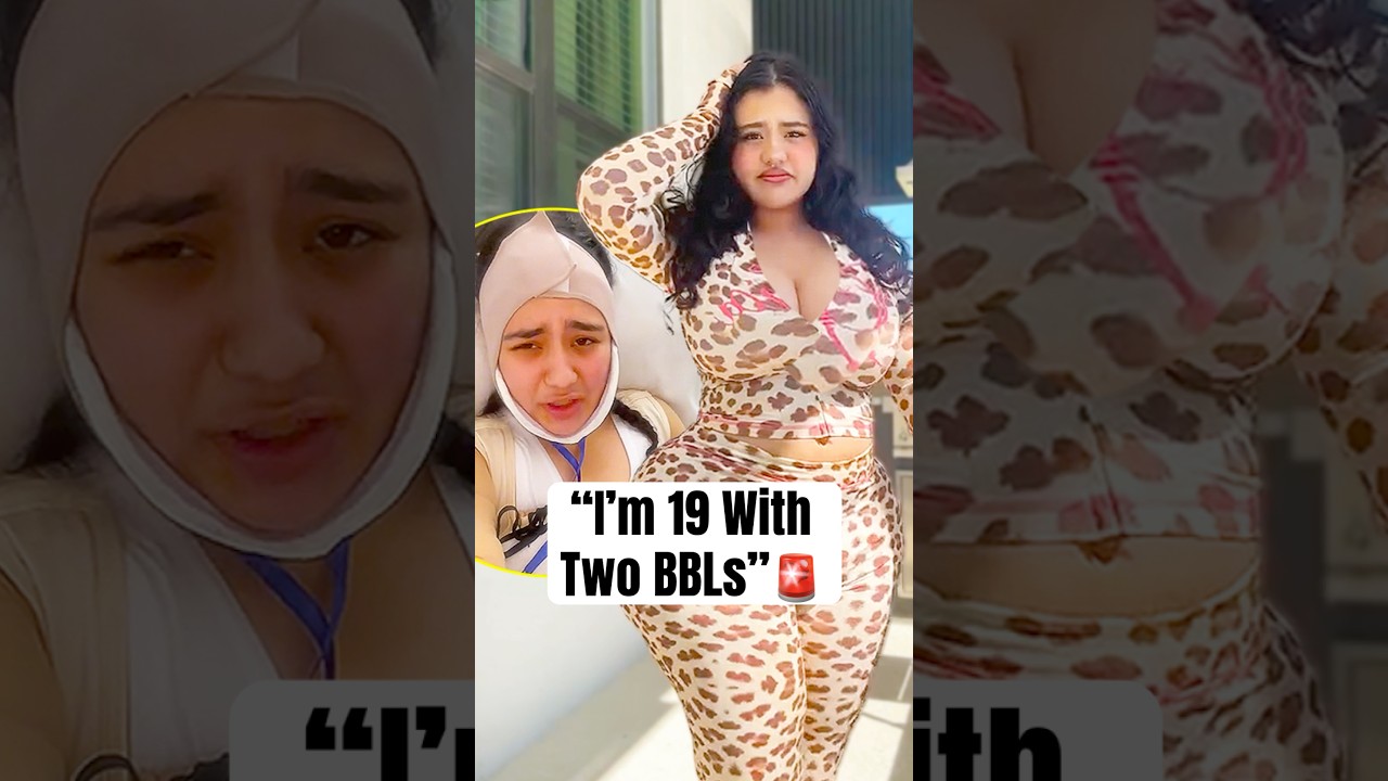 &laquo;Мне 19, и у меня две операции BBL&raquo; #shorts #mayling #bbl