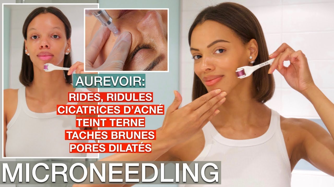 Microneedling à la Maison | Guide Complet