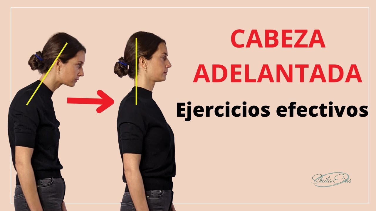CABEZA ADELANTADA: corrígela AHORA con 2 ejercicios (FUNCIONAN!)