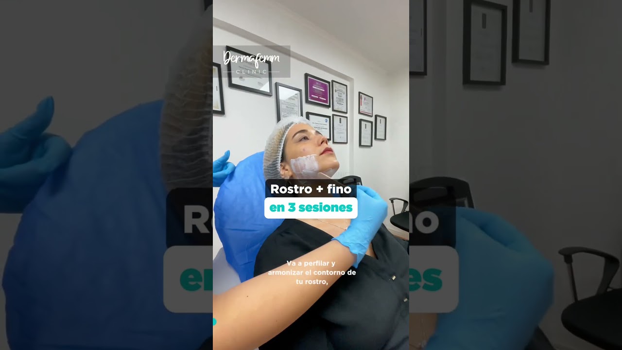 La aplicaci&oacute;n de enzimas act&uacute;an en la grasa localizada de la papada, ayudando a definir el rostro🤩