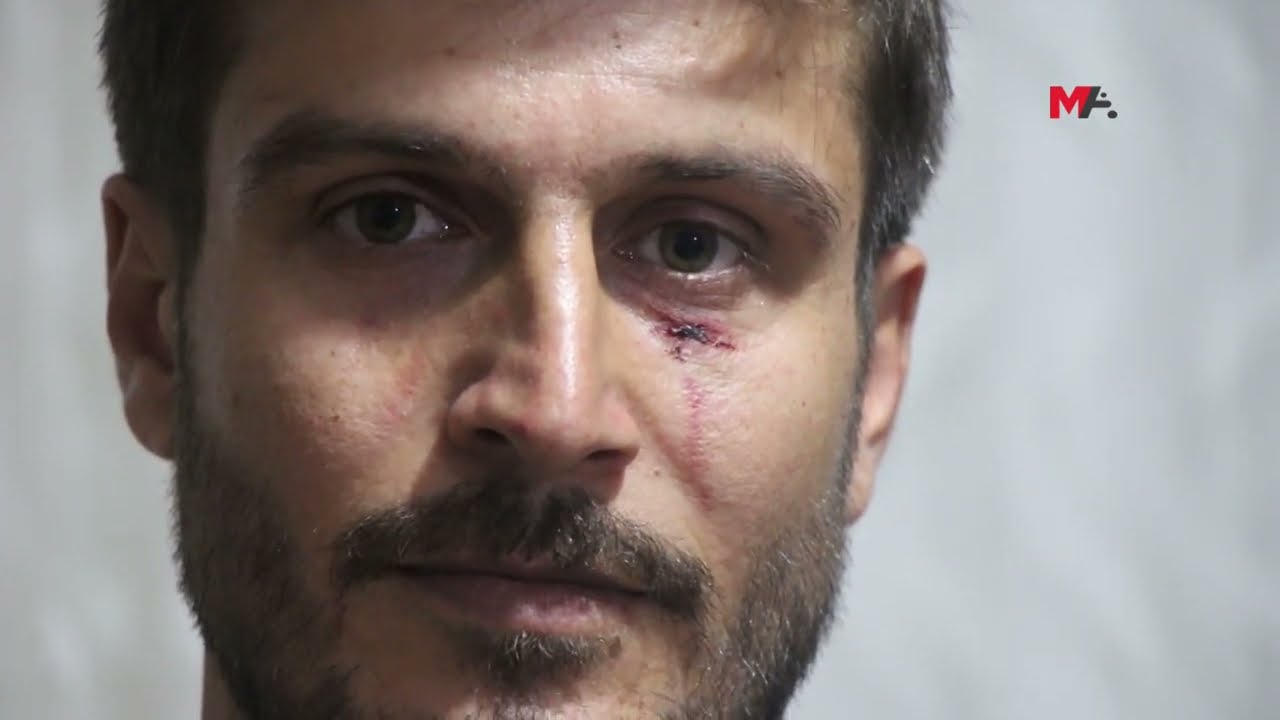 BİSMİL’DE POLİS ŞİDDETİ: ÇOCUĞUYLA BİRLİKTE YARALANDI
