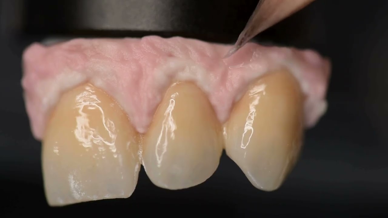 Tutorial: Gingiva with HeraCeram Zirkonia 750 & HeraCeram Stains universal