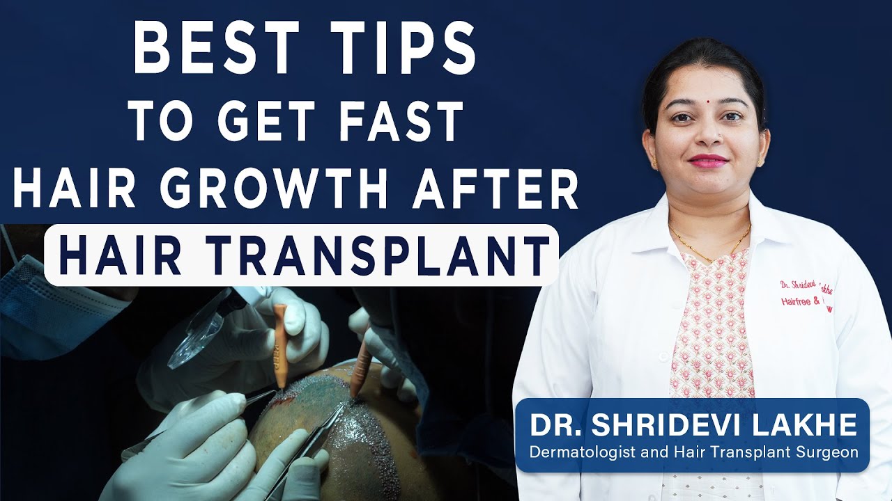 Best tips to Get fast Hair Growth after Hair Transplant || Medication after Hair Transplant