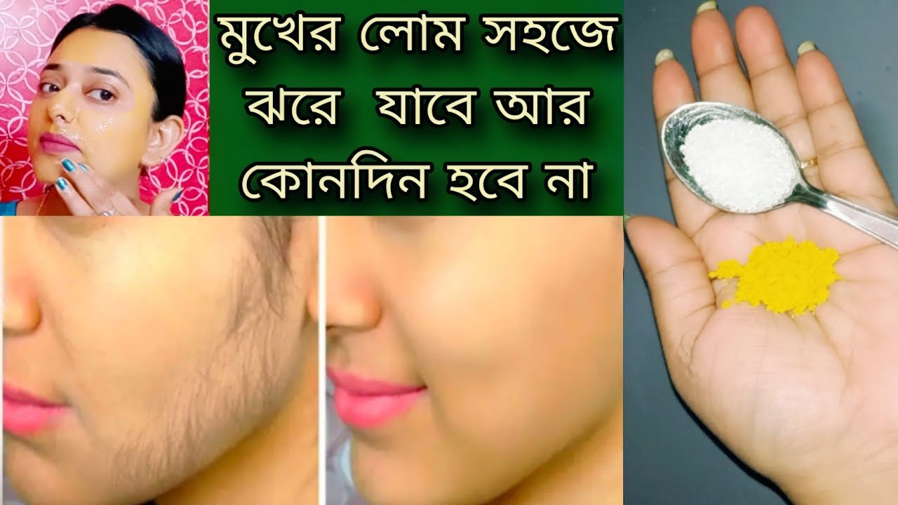 মুখের লোম গজানো বন্ধ হয়ে যাব, অবাঞ্ছিত লোম দূর করার উপায়/how to remove facial hair