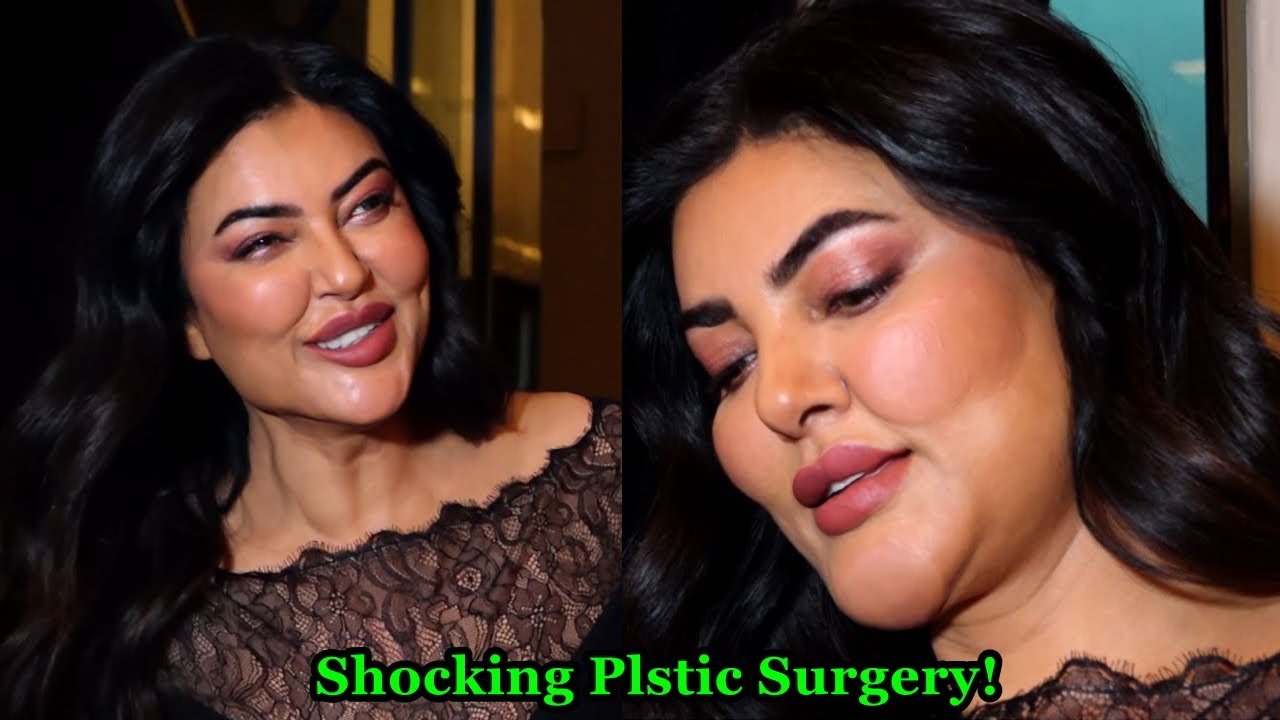 Sushmita Sen Looks Unrecognizable after her Plastic Surgery and Botox , and Lip Fillers!
