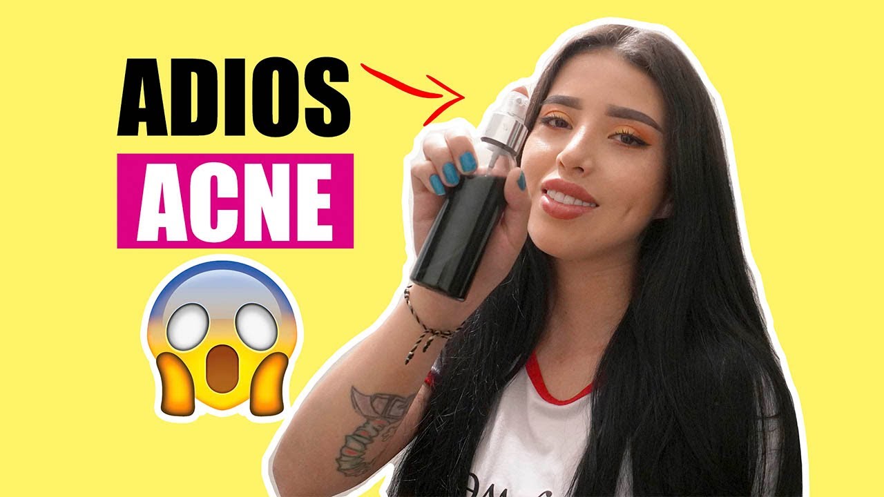ADIOS ACNE/ T&Oacute;NICO casero para PIEL GRASA