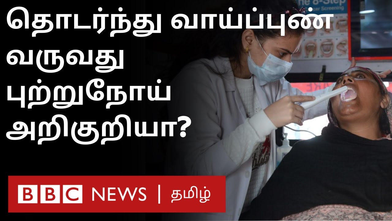 Tobacco பழக்கம் இல்லாதவர்களுக்கும் Oral Cancer வருவதற்கான காரணம் என்ன? Dental Surgeon Explains