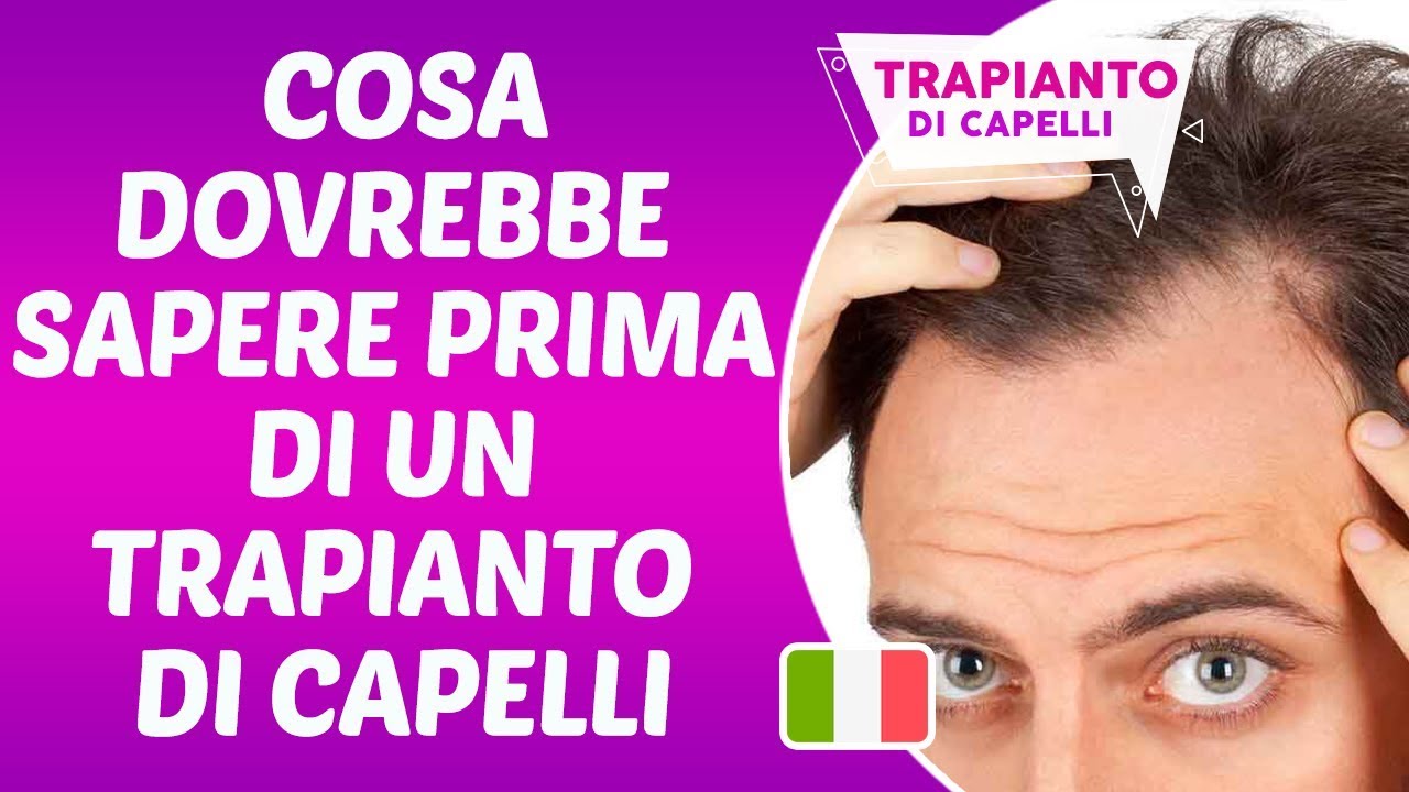 Cosa Dovrebbe Sapere Prima Di Un Trapianto Di Capelli - Dr. Hamid AYDIN