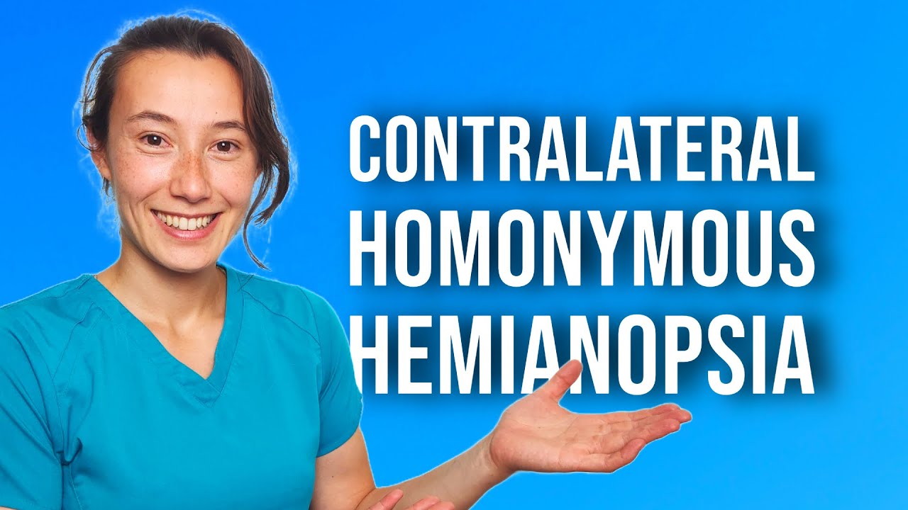 Contralateral Homonymous Hemianopsia