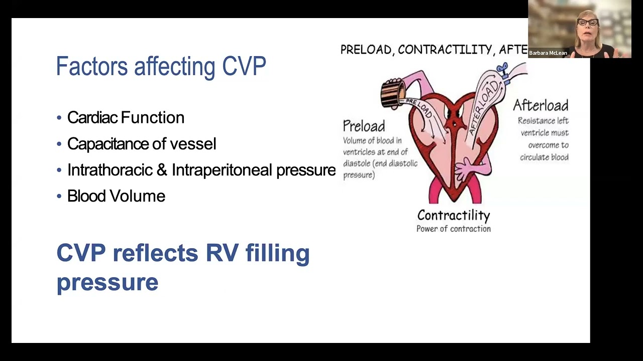 CVP and ECG