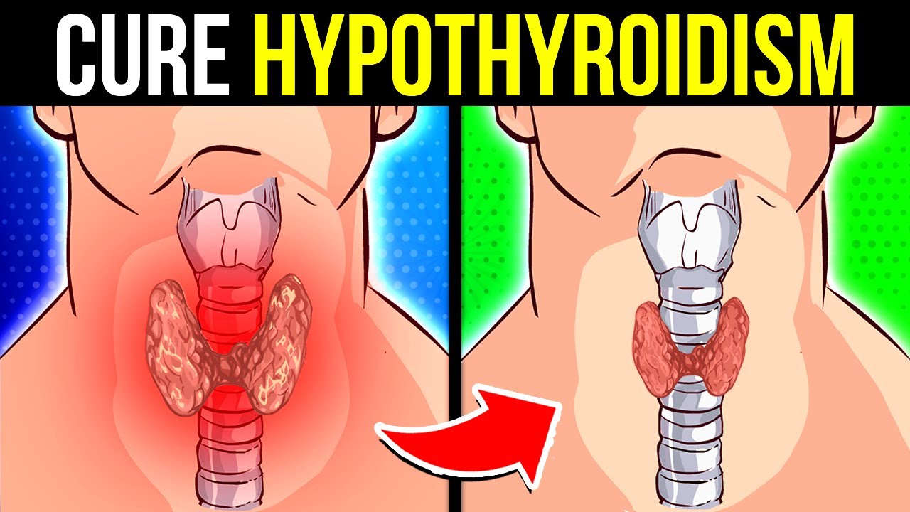 POWERFUL Vitamins & Minerals for Hypothyroidism RELIEF