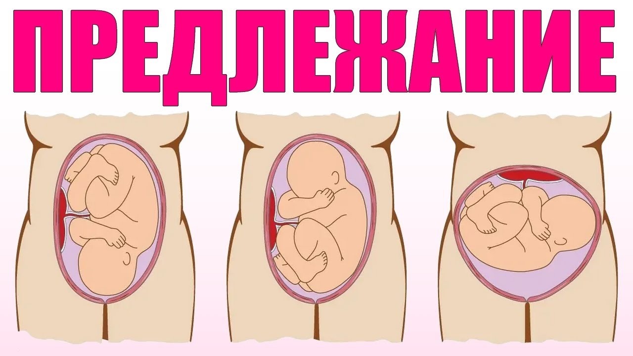 ПОЛОЖЕНИЕ РЕБЕНКА В ЖИВОТЕ У МАТЕРИ   Как самостоятельно определить положение ребенка в животе 1080p